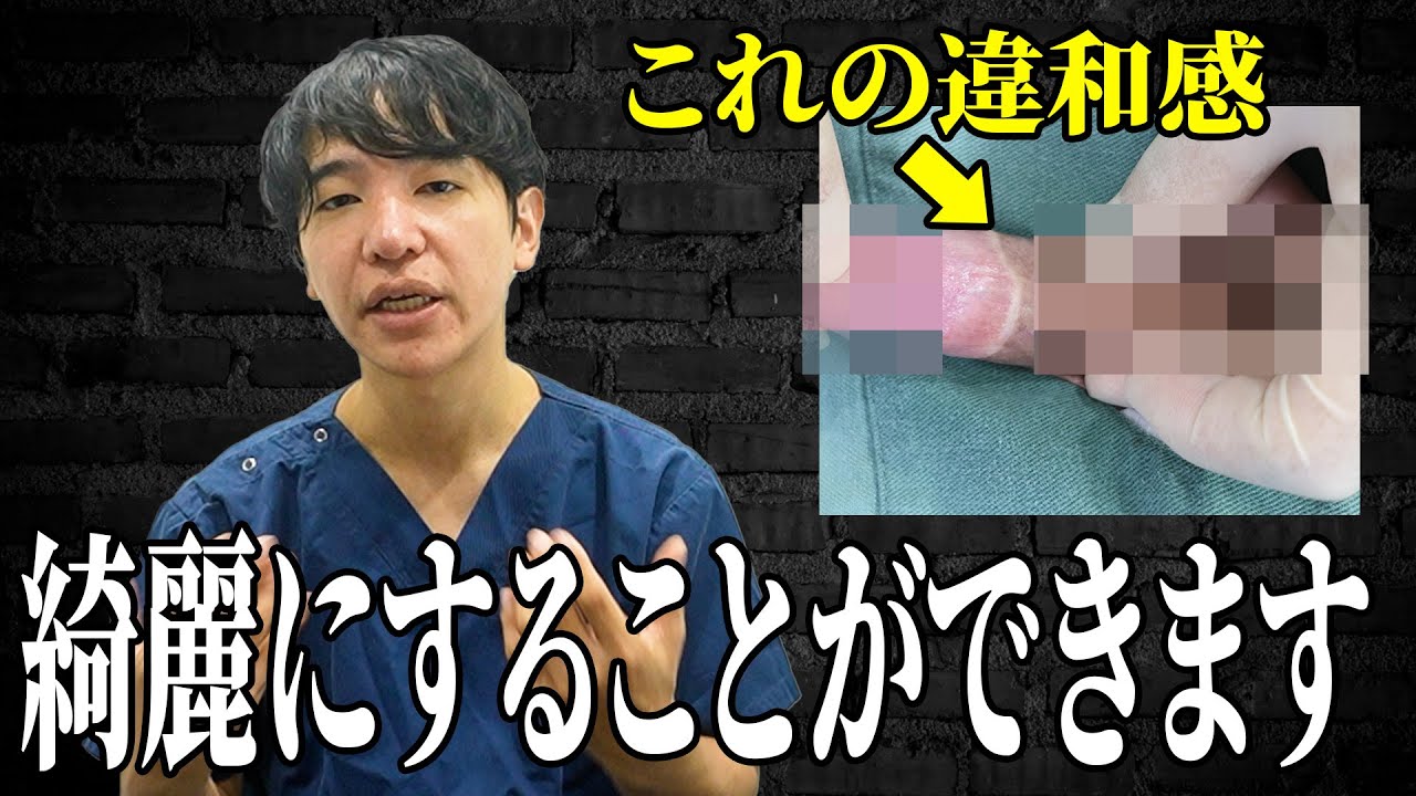 【違和感】包茎で失敗した箇所を綺麗に治す！手術法を紹介します