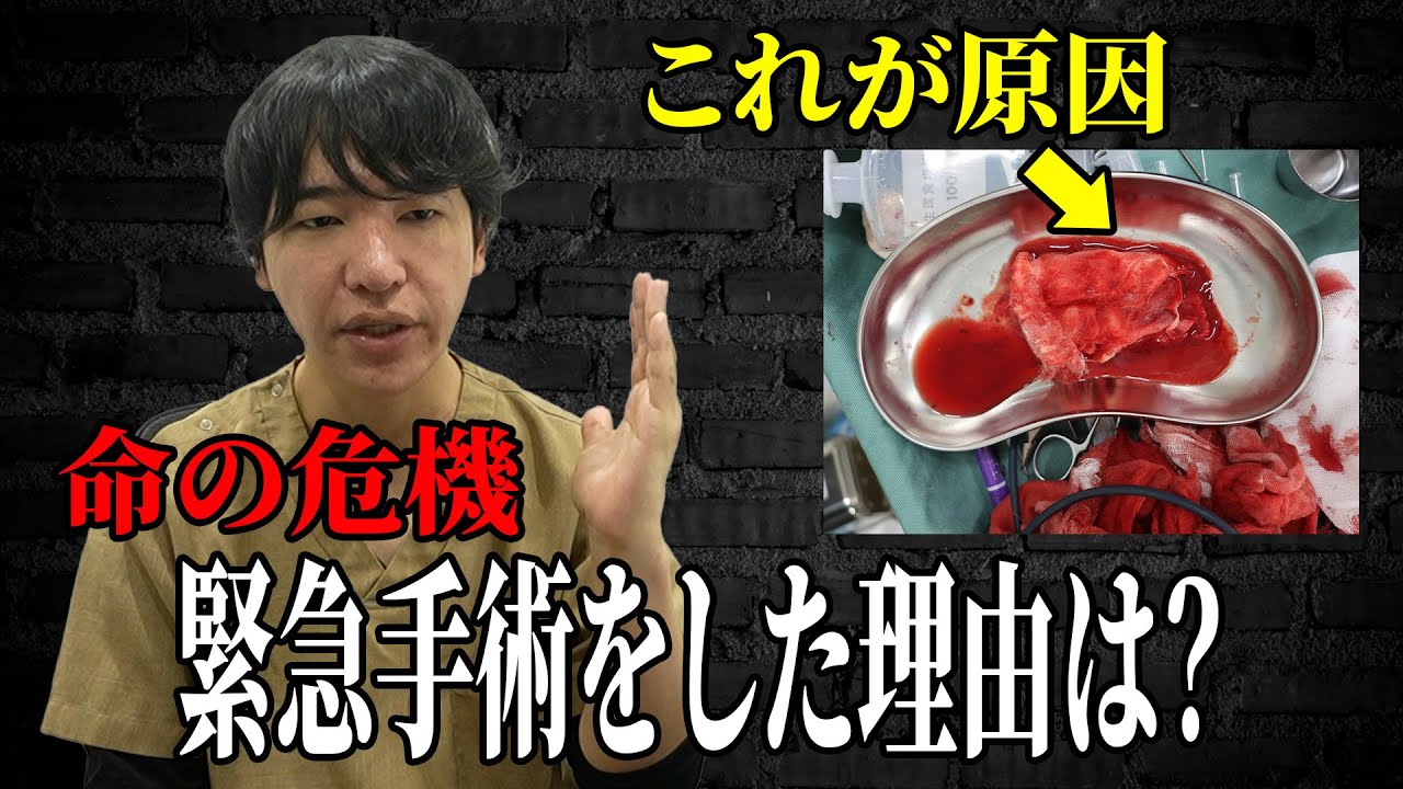 【危険】リパスで命の危機だった！？緊急手術をした症例を話します！