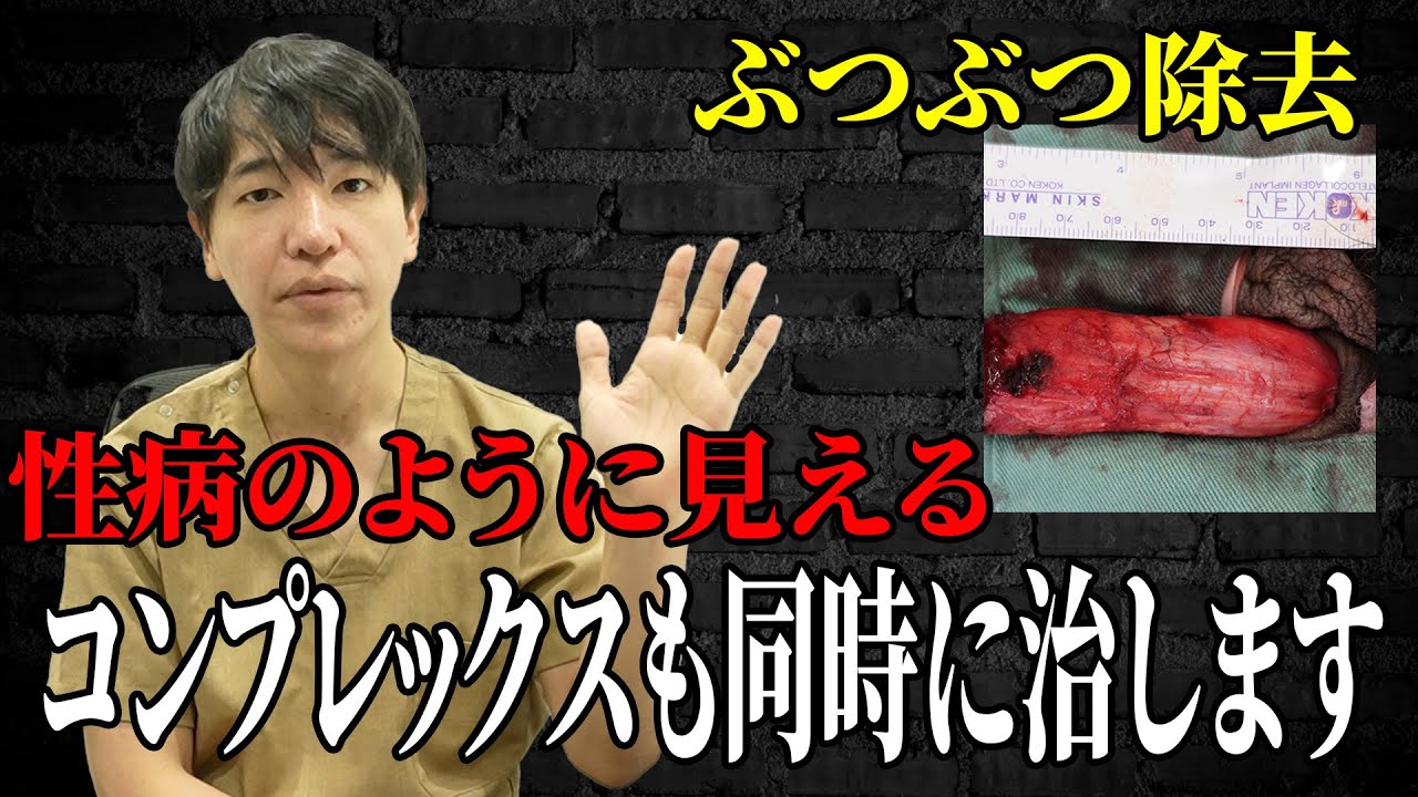 【必見】知らないと損するぶつぶつの治し方！性病の見分け方も教えます！！