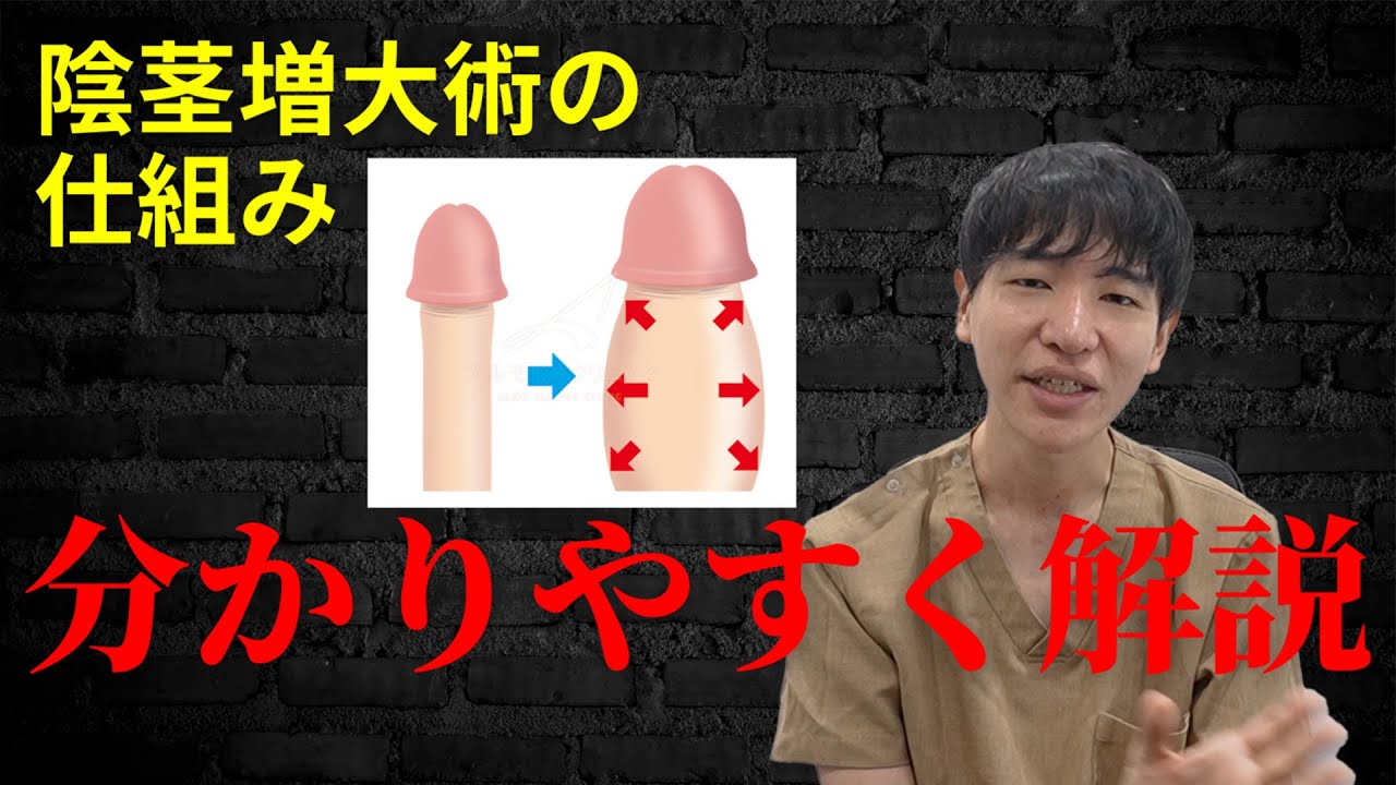 【必見】陰茎増大手術でアソコが大きくなる仕組みを解説します！