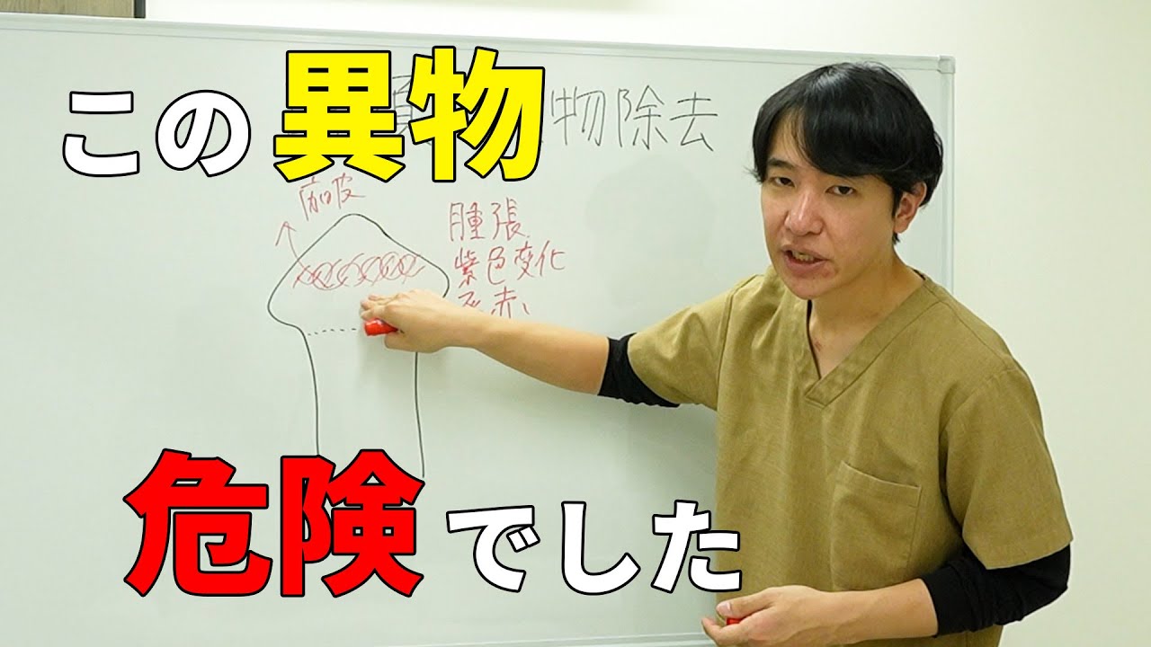 【異物除去】このまま放置していたら危険な状況でした！